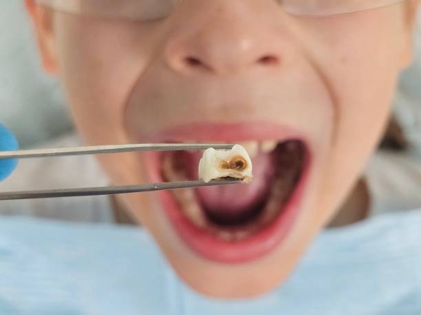 Best Emergency Care for Gum Disease in Fairfax, SC