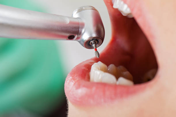 Best Weekend Emergency Dental Services in Fairfax, SC